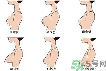 ​女性乳房下垂的原因是什么？女性乳房下垂的分类有哪些？