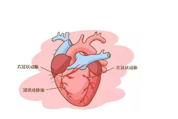 心肌炎是什么原因造成的 心肌炎是心脏病吗