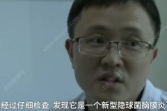 养鸽子患上怪病，新型隐球菌性脑膜炎死亡率高[多图]