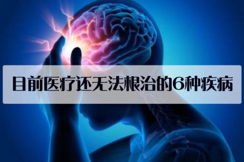 这6种疾病投入再多的金钱和努力目前也无法根治