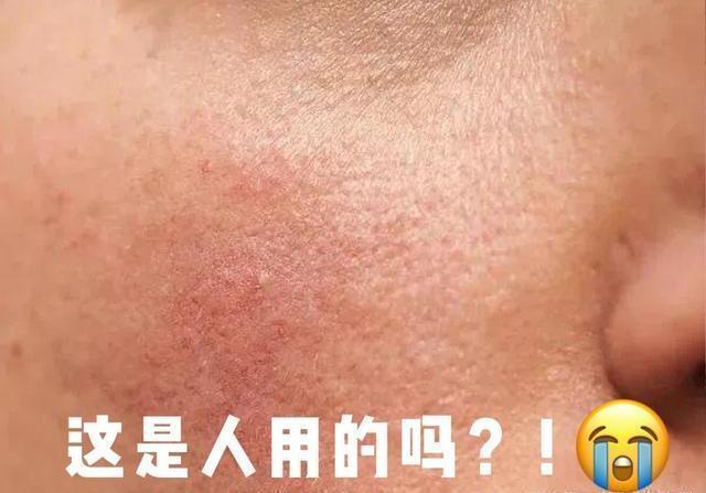 “洗面奶”查出致癌物！看看“黑名单”上是否有您常用的款？