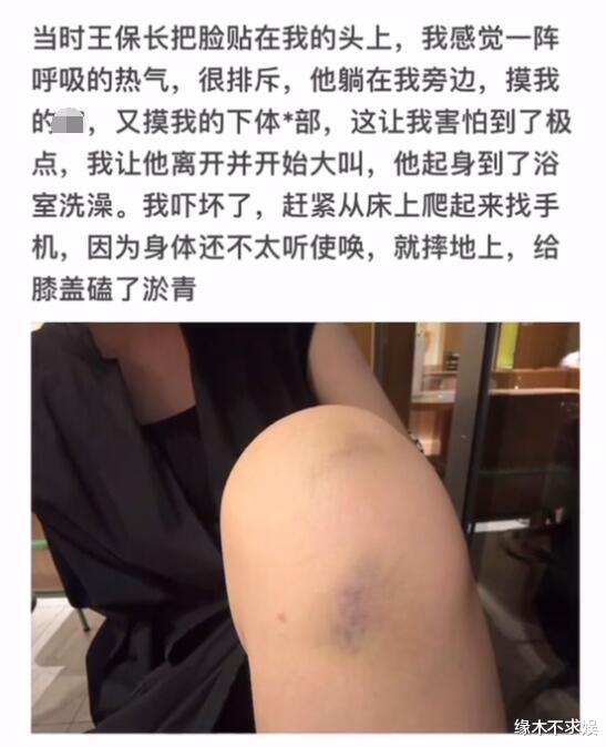 网红李嘉欣遭侵犯！发长文控诉倪海杉好兄弟王保长，晒伤痕太惊心