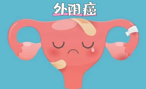 23岁女子确诊外阴癌5个坏习惯要尽早改