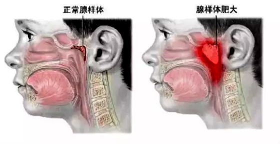 人为什么要用鼻子呼吸,用鼻子呼吸的好处